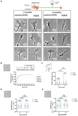 Frataxin Deficit Leads to Reduced Dynamics of Growth Cones in Dorsal Root Ganglia Neurons of Friedreich’s Ataxia YG8sR Model: A Multilinear Algebra Approach